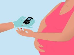 Gestational Diabetes: Managing Blood Sugar During Pregnancy
