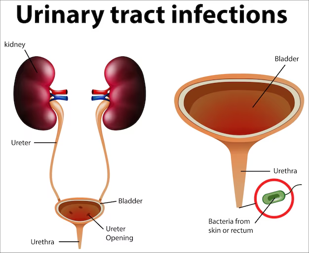 Ayurvedic Solutions for Urinary Tract Health