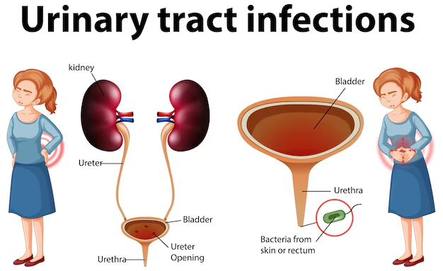 Understanding Urinary Disorders in Ayurveda: A Comprehensive Guide