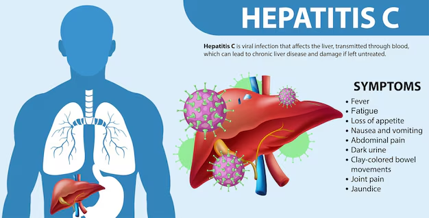Exploring Ayurveda for Hepatitis C: An Integrative Approach