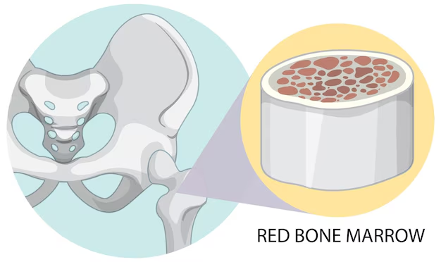 Understanding Red Bone Marrow Disorders through Ayurveda